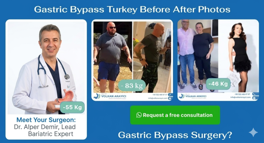 Turkey’s Top Gastric Sleeve Clinics for International Patients